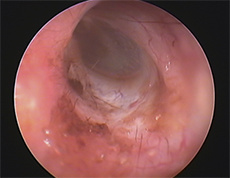 当院では耳内視鏡システム（オトスコープ）による専門的な耳処置を行っています
